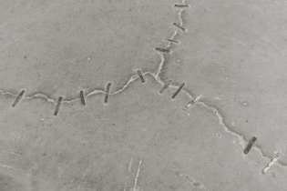 Kader Attia Traditional Repair, Immaterial Injury (detail) 2014
