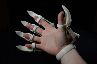 3D printed exoskeleton