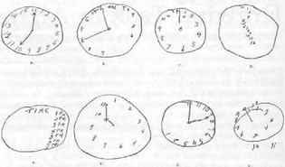 examples-of-clock-drawing-test-performance-identify-cognitive-impairment.png