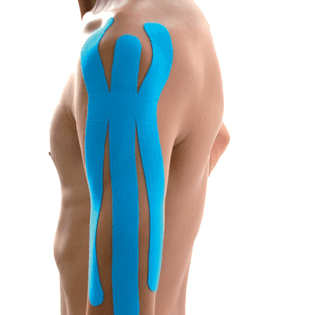 sports-tape-easyinsmile-precut-kinesiology-tape-muscles-pain-reduce-kinesiology-sports-taping-2-pcs-pack.jpg