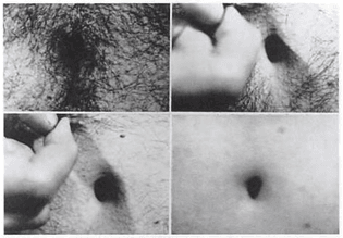Vito Acconci, Openings, 1970, gelatin silver print, documentation of performance.   “Acconci's body-based performances are often willfully provocative in their testing of physical limits and controlled actions. Here, as the camera frames Acconci's stomach in close up, he painstakingly pulls out each hair from the skin around his navel.”--Electronic Arts Intermix