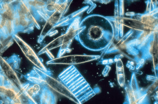 Light microscopy of Diatom