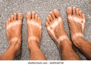 sunburn-on-feet-man-woman-260nw-1420534718.jpg