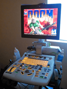 Doom on an Ultrasound Scanner
