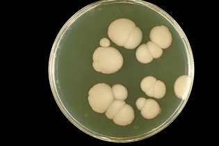 440px-candida_albicans_phil_3192_lores.jpg