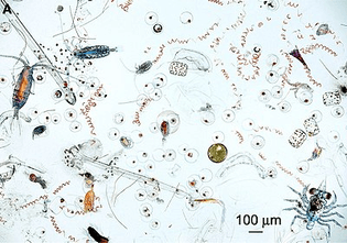 400px-marine_microplankton.jpg