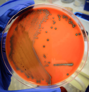 Listeria monocytogenes via magic_microbiology