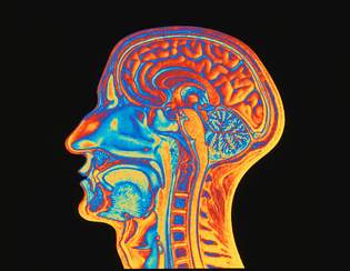 coloured-mri-scan-of-the-human-head-side-view-pasieka.jpg