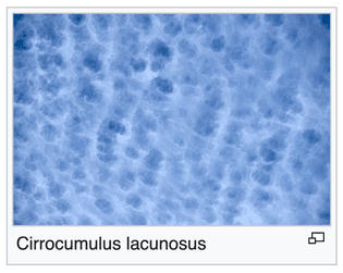 cirrocumulus-lacunosus.png