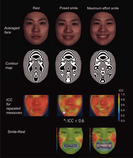 Test-retest reliability of smile tasks using three-dimensional facial topography