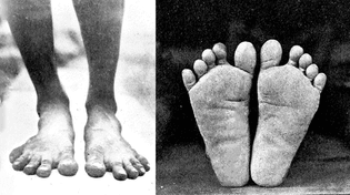 Unshod feet