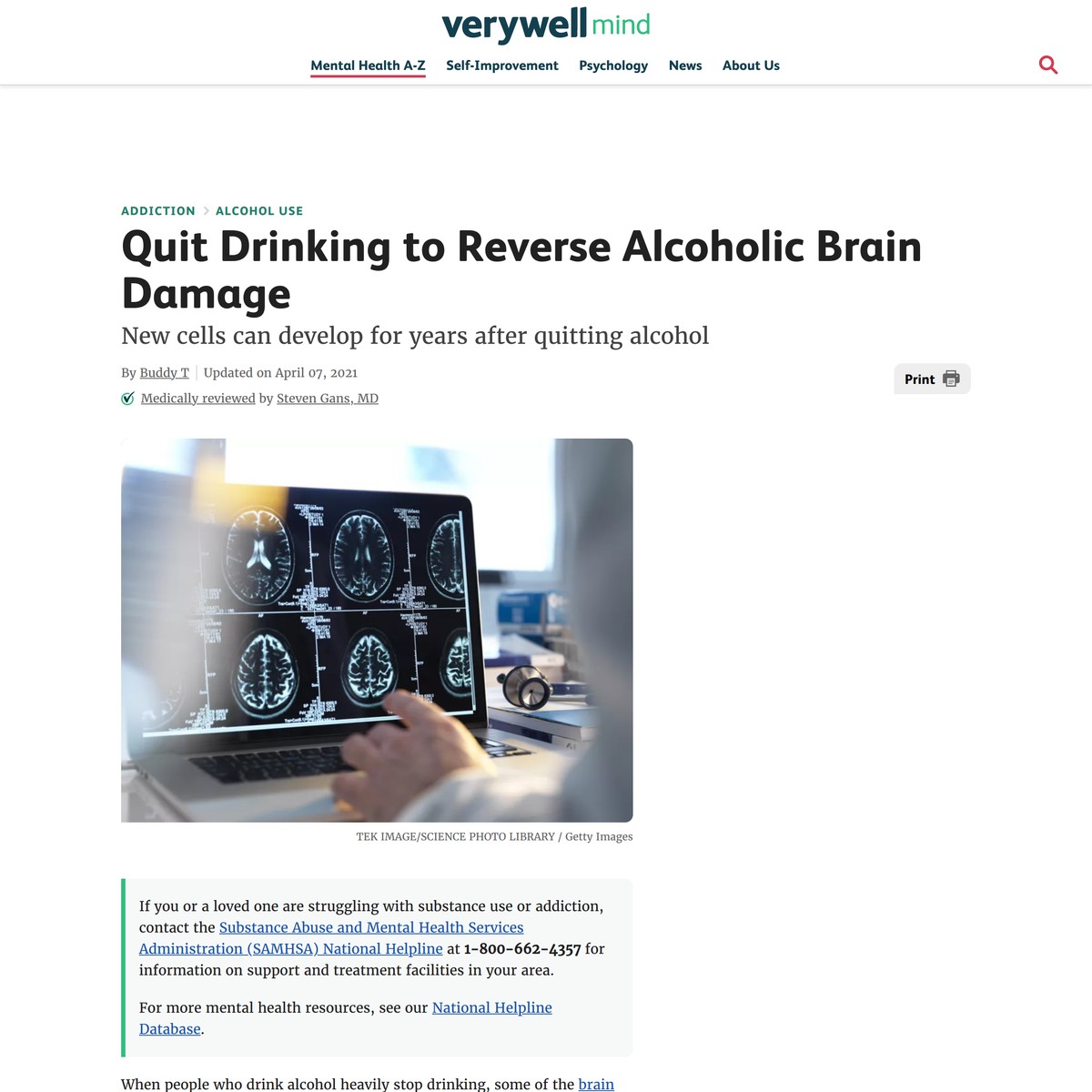 how-to-reverse-brain-damage-from-long-term-alcohol-use-are-na