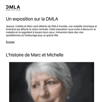 DMLA – Dans tes yeux