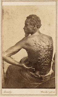 800px-Gordon-_scourged_back-_NPG-_1863.jpg
