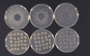 1200px-Pseudomonas_syringae_cultures.jpg