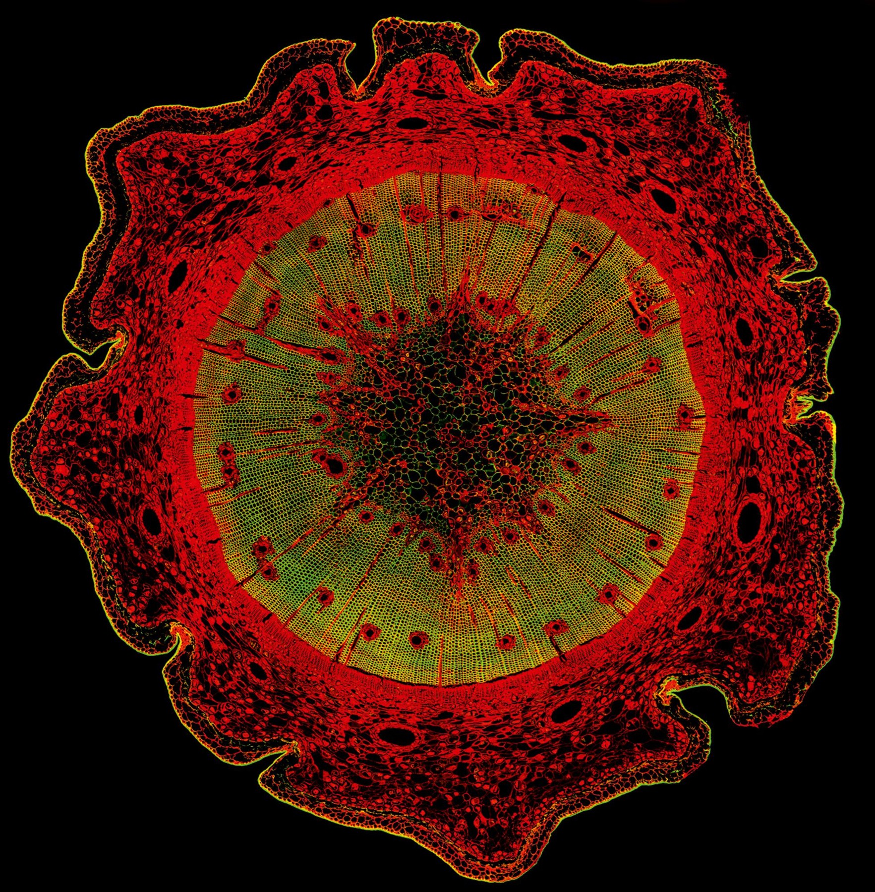 Fluorescence Microscopy