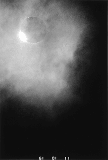 The Last Eclipse of the Sun, Diamond Ring, 1988
