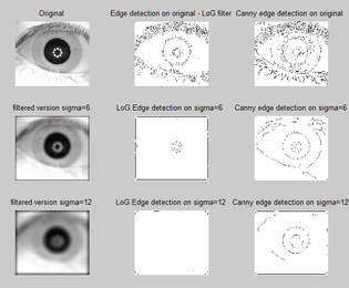 edge-detection-by-canny-and-laplacian-of-gaussian-log-methods.png